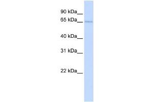 WB Suggested Anti-TKTL2 Antibody Titration:  0. (TKTL2 antibody  (N-Term))