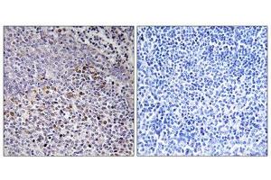 Immunohistochemistry analysis of paraffin-embedded human tonsil tissue using Cytochrome c-type Heme Lyase antibody. (HCCS antibody  (Internal Region))