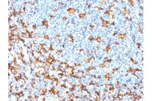 ABIN6383787 to AIF1/IBA1 was successfully used to stain T cells in human tonsil sections. (Recombinant Iba1 antibody)
