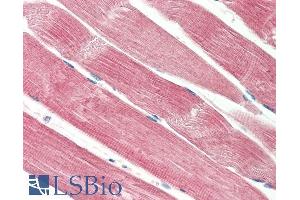 ABIN5539898 (5µg/ml) staining of paraffin embedded Human Skeletal Muscle. (THNSL2 antibody  (Internal Region))