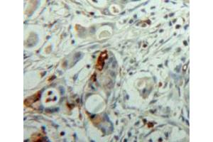 Used in DAB staining on fromalin fixed paraffin-embedded pancreas tissue (NEU1 antibody  (AA 141-286))