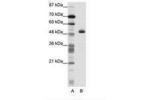 Image no. 1 for anti-Zinc Finger Protein 213 (ZNF213) (N-Term) antibody (ABIN202568) (ZNF213 antibody  (N-Term))