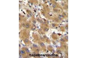 Immunohistochemistry (IHC) image for anti-Haptoglobin Related Protein (HPR) antibody (ABIN2996022)