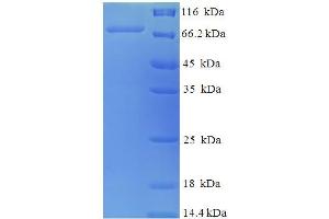 PDIA2 Protein (AA 21-527) (His-SUMO Tag)
