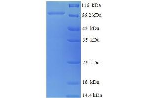 SDS-PAGE (SDS) image for Protein Disulfide Isomerase Family A, Member 2 (PDIA2) (AA 21-527) protein (His-SUMO Tag) (ABIN5710081)