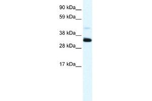 WB Suggested Anti-ANXA3 Antibody Titration:  1.