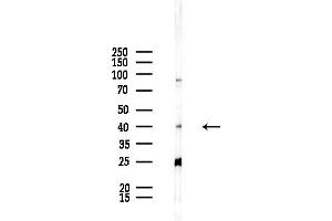 Western blot analysis of lysates from Rat liver, using TAS2R46 Antibody at 1/1000 dilution.