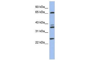 ATP6V1A antibody used at 1 ug/ml to detect target protein.