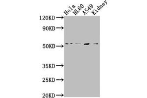 Western Blot Positive WB detected in: Hela whole cell lysate, HL60 whole cell lysate, A549 whole cell lysate, Mouse kidney tissue All lanes: ILK antibody at 1:2000 Secondary Goat polyclonal to rabbit IgG at 1/50000 dilution Predicted band size: 52, 45, 37 kDa Observed band size: 51 kDa (Recombinant ILK antibody)