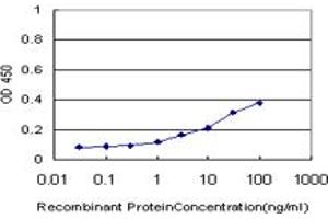 Detection limit for recombinant GST tagged PIP5K2A is approximately 3ng/ml as a capture antibody. (PIP4K2A antibody  (AA 304-365))