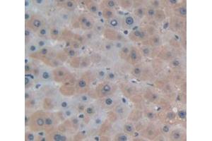 IHC-P analysis of Human Tissue, with DAB staining. (GAA antibody  (AA 761-919))