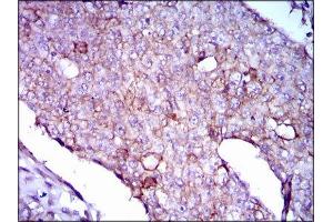 Immunohistochemistry (IHC) image for anti-Lipoprotein (Lp(a)) (AA 4330-4521) antibody (ABIN1845714) (Lp(a) antibody  (AA 4330-4521))