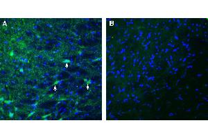Expression of MEGF10 in rat substantia nigra.