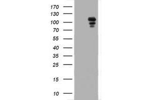 Image no. 1 for anti-Progesterone Receptor (PGR) antibody (ABIN1500186) (Progesterone Receptor antibody)