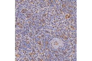 IHC analysis of ITK using anti-ITK antibody (ABIN7601855). (ITK antibody  (AA 49-465))