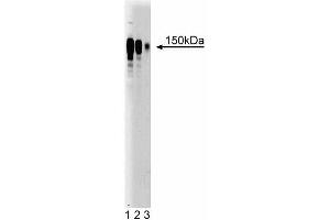 Western blot analysis of Ataxin-2 on Jurkat cell lysate (left).