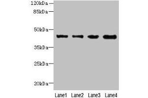Western blot All lanes: KCTD9 antibody at 8 μg/mL Lane 1: MCF-7 whole cell lysate Lane 2: HepG2 whole cell lysate Lane 3: HT29 whole cell lysate Lane 4: U251 whole cell lysate Secondary Goat polyclonal to rabbit IgG at 1/10000 dilution Predicted band size: 43 kDa Observed band size: 43 kDa (KCTD9 antibody  (AA 1-200))