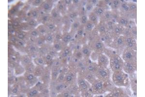 IHC-P analysis of Mouse Liver Tissue, with DAB staining. (ACAA1 antibody  (AA 182-424))