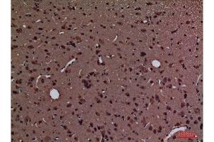 Immunohistochemistry (IHC) image for anti-Peptidylprolyl Isomerase A (Cyclophilin A) (PPIA) (Internal Region) antibody (ABIN6284334)