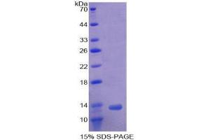 SDS-PAGE (SDS) image for Activin A Receptor, Type IB (ACVR1B) (AA 24-126) protein (His tag) (ABIN1169763)