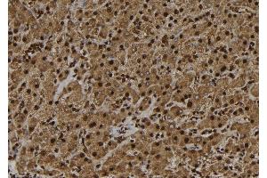 ABIN6272453 at 1/100 staining Human liver tissue by IHC-P. (UBE3B antibody  (C-Term))