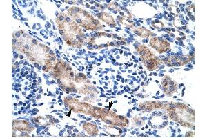 CLIC1 antibody was used for immunohistochemistry at a concentration of 4-8 ug/ml to stain Epithelial cells of renal tubule (arrows) in Human Kidney. (CLIC1 antibody  (N-Term))