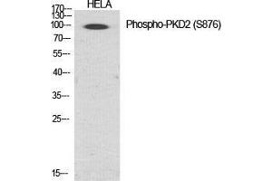 Western Blot (WB) analysis of specific cells using Phospho-PKD2 (S876) Polyclonal Antibody. (PKD2 antibody  (pSer876))