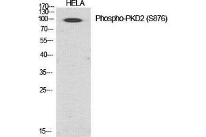 Western Blot (WB) analysis of specific cells using Phospho-PKD2 (S876) Polyclonal Antibody.