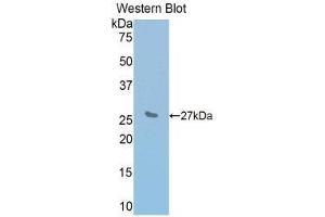 Western Blotting (WB) image for anti-Interleukin 2 Receptor, beta (IL2RB) (AA 27-240) antibody (ABIN1859416) (IL2 Receptor beta antibody  (AA 27-240))
