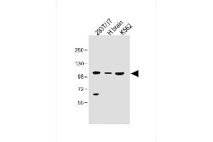 All lanes : Anti-SLC14A2 Antibody (N-Term) at 1:500 dilution Lane 1: 293T/17 whole cell lysate Lane 2: Human brain lysate Lane 3: K562 whole cell lysate 293T/17 whole cell lysate at 30 μg per lane.