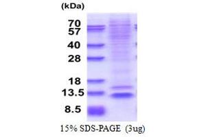 SDS-PAGE (SDS) image for Nucleoporin 62kDa C-terminal Like (NUP62CL) (AA 1-72) protein (His tag) (ABIN5853609)