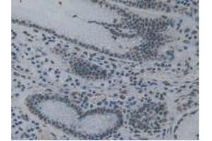 Figure. (TOR1A antibody  (AA 33-321))
