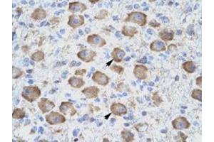 Immunohistochemical staining (Formalin-fixed paraffin-embedded sections) of human brain with TNFRSF18 polyclonal antibody  at 4-8 ug/mL working concentration. (TNFRSF18 antibody  (C-Term))
