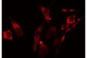 ABIN6278264 staining NIH-3T3  cells by IF/ICC. (LGALS8 antibody  (Internal Region))