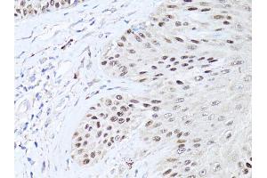 Immunohistochemistry of paraffin-embedded human skin using TP63 antibody (ABIN5971164) at dilution of 1:50 (40x lens). (p63 antibody)