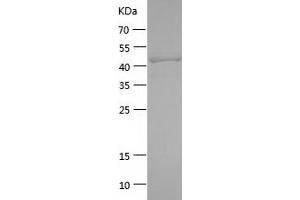 Western Blotting (WB) image for Lymphocyte-Activation Gene 3 (LAG3) (AA 23-222) protein (His-IF2DI Tag) (ABIN7123802) (LAG3 Protein (AA 23-222) (His-IF2DI Tag))