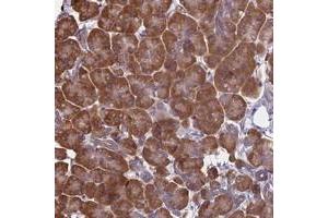Immunohistochemical staining of human pancreas with KIAA1143 polyclonal antibody  shows strong cytoplasmic positivity in exocrine glandular cells at 1:1000-1:2500 dilution. (KIAA1143 antibody)