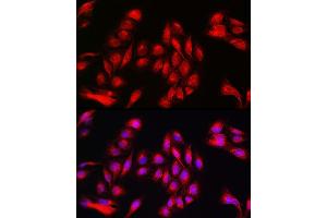 Immunofluorescence analysis of U2OS cells using Annexin  Rabbit pAb (ABIN6127436, ABIN6136920, ABIN6136921 and ABIN6223291) at dilution of 1:50 (40x lens). (Annexin A11 antibody  (AA 276-505))