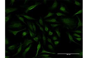 Immunofluorescence of monoclonal antibody to IFT20 on HeLa cell. (IFT20 antibody  (AA 1-148))