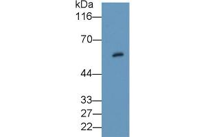 Detection of PKBb in Rat Thyroid lysate using Polyclonal Antibody to Protein Kinase B Beta (PKBb) (AKT2 antibody  (AA 142-412))