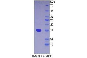SDS-PAGE analysis of Mouse Lymphocyte Antigen 96 Protein.