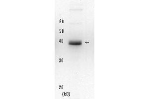 Western Blotting (WB) image for anti-Xeroderma Pigmentosum, Complementation Group A (XPA) (full length) antibody (ABIN3200998) (XPA antibody  (full length))