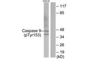 Western blot analysis of extracts from COLO205 cells, using Caspase 9 (Phospho-Tyr153) Antibody. (Caspase 9 antibody  (pTyr153))