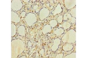 Immunohistochemistry of paraffin-embedded human thyroid tissue using ABIN7154959 at dilution of 1:100 (HEBP2 antibody  (AA 2-205))