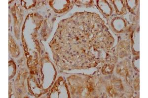 IHC image of ABIN7127577 diluted at 1:100 and staining in paraffin-embedded human kidney tissue performed on a Leica BondTM system. (Recombinant CD51 antibody)