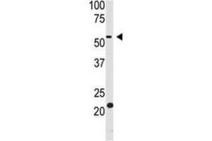Western Blotting (WB) image for anti-beta-Site APP-Cleaving Enzyme 2 (BACE2) antibody (ABIN3002512) (BACE2 antibody)