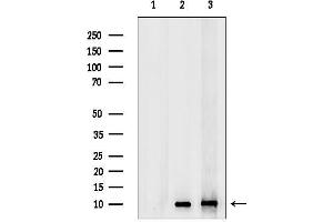 anti-Gonadotropin-Releasing Hormone 1 (Luteinizing-Releasing Hormone) (GNRH1) antibody
