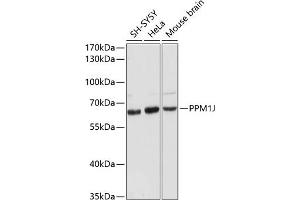 Western blot analysis of extracts of various cell lines, using PPM1J antibody (ABIN6132509, ABIN6146046, ABIN6146047 and ABIN6216619) at 1:3000 dilution. (PPM1J antibody  (AA 130-260))