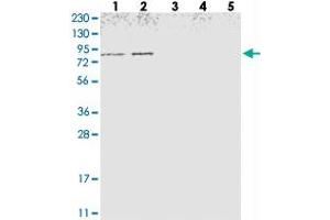 Western blot analysis of Lane 1: RT-4, Lane 2: U-251 MG, Lane 3: Human Plasma, Lane 4: Liver, Lane 5: Tonsil with NOL11 polyclonal antibody  at 1:250-1:500 dilution.