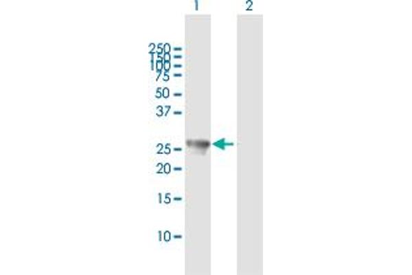 PSMA8 antibody  (AA 1-250)